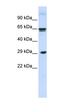 C-Type Lectin Domain Family 4 Member M antibody, orb325004, Biorbyt, Western Blot image 