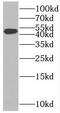 Solute Carrier Family 37 Member 4 antibody, FNab07958, FineTest, Western Blot image 