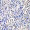 Protein Kinase C Beta antibody, 15-109, ProSci, Immunohistochemistry frozen image 