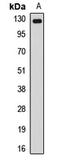 Nucleoporin 133 antibody, LS-C668530, Lifespan Biosciences, Western Blot image 