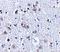 BR Serine/Threonine Kinase 1 antibody, GTX85055, GeneTex, Immunohistochemistry paraffin image 