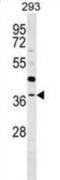 TRNA Methyltransferase 10B antibody, abx029984, Abbexa, Western Blot image 