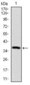 Sequestosome 1 antibody, abx016000, Abbexa, Western Blot image 