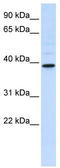 Chitinase Acidic antibody, TA329463, Origene, Western Blot image 