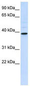 Chitinase Acidic antibody, TA329463, Origene, Western Blot image 