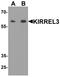 Kirre Like Nephrin Family Adhesion Molecule 3 antibody, PA5-72824, Invitrogen Antibodies, Western Blot image 
