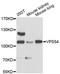 VPS54 Subunit Of GARP Complex antibody, A07056, Boster Biological Technology, Western Blot image 