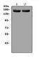 Mediator Complex Subunit 14 antibody, A04799-2, Boster Biological Technology, Western Blot image 