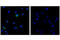 Toll Like Receptor 9 antibody, 13674S, Cell Signaling Technology, Immunofluorescence image 