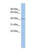 Speckle Type BTB/POZ Protein Like antibody, NBP1-79345, Novus Biologicals, Western Blot image 