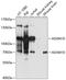 ADAM Metallopeptidase Domain 10 antibody, 24-024, ProSci, Western Blot image 