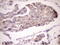 Eukaryotic Translation Initiation Factor 3 Subunit D antibody, M06212, Boster Biological Technology, Immunohistochemistry paraffin image 