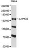 Splicing Factor 3b Subunit 3 antibody, LS-C748918, Lifespan Biosciences, Western Blot image 