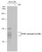 Fibroblast Growth Factor Receptor 1 antibody, GTX133527, GeneTex, Western Blot image 