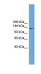 Coiled-Coil Domain Containing 146 antibody, NBP1-57040, Novus Biologicals, Western Blot image 