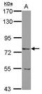 Leucine Rich Repeat Neuronal 2 antibody, GTX103566, GeneTex, Western Blot image 