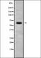 ACOX2 antibody, orb337950, Biorbyt, Western Blot image 