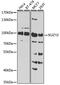 SUZ12 Polycomb Repressive Complex 2 Subunit antibody, GTX64485, GeneTex, Western Blot image 