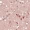 G-Rich RNA Sequence Binding Factor 1 antibody, MBS301826, MyBioSource, Immunohistochemistry paraffin image 