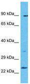 TBC1 Domain Family Member 28 antibody, TA334976, Origene, Western Blot image 