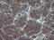 Pseudouridine 5'-Phosphatase antibody, M13748, Boster Biological Technology, Immunohistochemistry paraffin image 