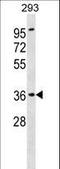 ATPase H+ Transporting Accessory Protein 2 antibody, LS-B9982, Lifespan Biosciences, Western Blot image 