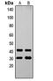 Putative transcription factor Ovo-like 1 antibody, LS-C356239, Lifespan Biosciences, Western Blot image 