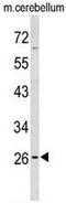 Peroxisomal Membrane Protein 4 antibody, GTX80511, GeneTex, Western Blot image 