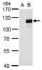 Myocardin Related Transcription Factor A antibody, PA5-35928, Invitrogen Antibodies, Western Blot image 