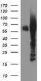 Tyrosine Hydroxylase antibody, TA506551BM, Origene, Western Blot image 