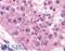 Melanoma-associated antigen 2 antibody, LS-B883, Lifespan Biosciences, Immunohistochemistry frozen image 