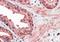 Cyclin D1 Binding Protein 1 antibody, orb18795, Biorbyt, Immunohistochemistry paraffin image 