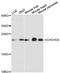 Coiled-Coil-Helix-Coiled-Coil-Helix Domain Containing 4 antibody, LS-C748200, Lifespan Biosciences, Western Blot image 