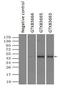 Alpha-1-antitrypsin antibody, GTX83666, GeneTex, Immunoprecipitation image 