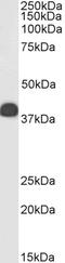 Keratin 13 antibody, 46-751, ProSci, Western Blot image 