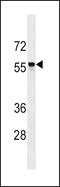 Solute Carrier Family 22 Member 2 antibody, 60-152, ProSci, Western Blot image 