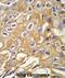Receptor Interacting Serine/Threonine Kinase 3 antibody, abx033215, Abbexa, Immunohistochemistry paraffin image 