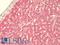 LMTD1 antibody, LS-B9551, Lifespan Biosciences, Immunohistochemistry paraffin image 