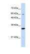 Leucine Rich Repeat Containing 57 antibody, NBP1-56321, Novus Biologicals, Western Blot image 