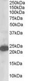 Stathmin-2 antibody, MBS420694, MyBioSource, Western Blot image 
