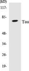 Microtubule Associated Protein Tau antibody, EKC1559, Boster Biological Technology, Western Blot image 