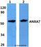 Annexin A7 antibody, LS-C411991, Lifespan Biosciences, Western Blot image 