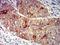 Folate Receptor Alpha antibody, NBP2-61773, Novus Biologicals, Immunohistochemistry paraffin image 