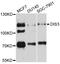 DIS3 Homolog, Exosome Endoribonuclease And 3'-5' Exoribonuclease antibody, STJ110333, St John