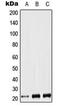 LIF Interleukin 6 Family Cytokine antibody, MBS820385, MyBioSource, Western Blot image 