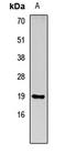 Regenerating Family Member 3 Gamma antibody, LS-C668980, Lifespan Biosciences, Western Blot image 
