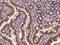 Adenosylhomocysteinase Like 1 antibody, GTX02194, GeneTex, Immunohistochemistry paraffin image 