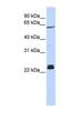 H1 Histone Family Member 0 antibody, NBP1-53000, Novus Biologicals, Western Blot image 