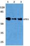 Arginyltransferase 1 antibody, A07459, Boster Biological Technology, Western Blot image 