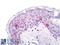 CD1a Molecule antibody, LS-B8558, Lifespan Biosciences, Immunohistochemistry paraffin image 